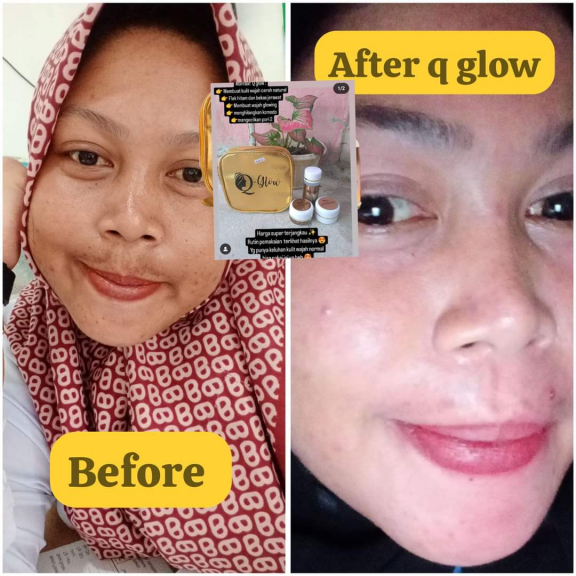 Skincare Q glow