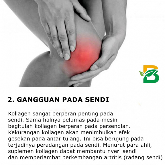 GAMAT KUNYIT ATAU COLLAGEN ISI 30 KAPSUL 