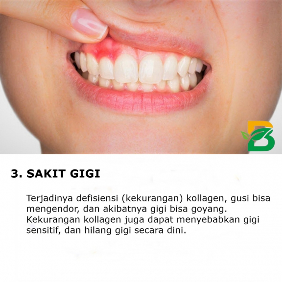 GAMAT KUNYIT ATAU COLLAGEN ISI 30 KAPSUL 