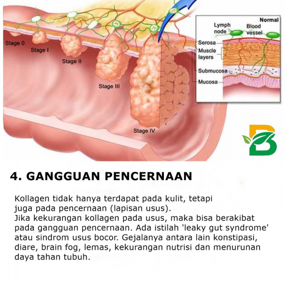 GAMAT KUNYIT ATAU COLLAGEN ISI 30 KAPSUL 