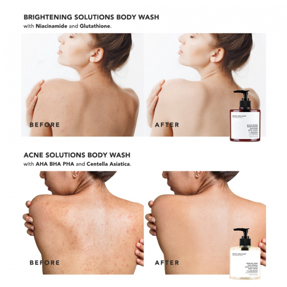 Grace and Glow English Pear and Freesia Anti Acne Solution Body Wash 400ml