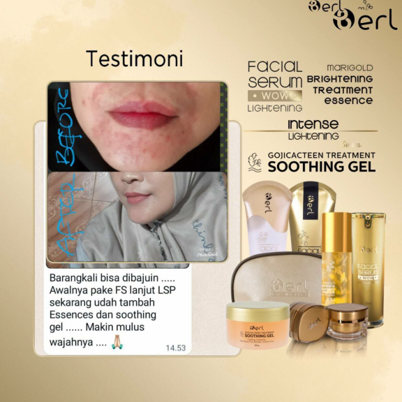 B erl Lightening Series